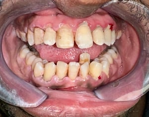 Before Image 4-1-25-4-1